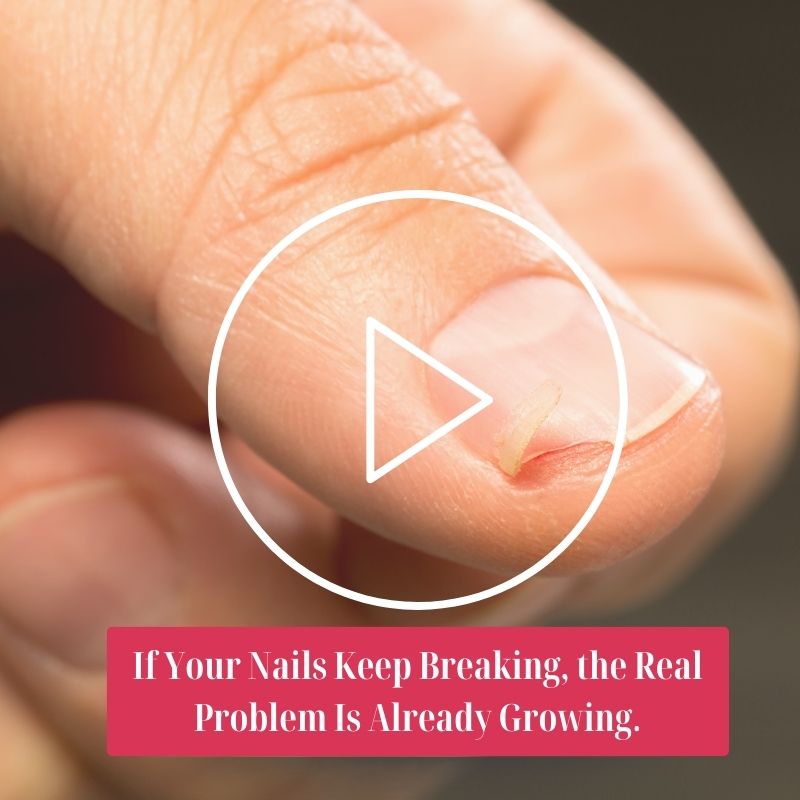 If Your Nails Keep Breaking, the Real Problem Is Already Growing_lp_nails